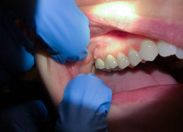 Best Emergency Cosmetic Dentistry in Belmont, VA