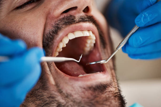 Best Holiday Emergency Dentist in Belmont, VA